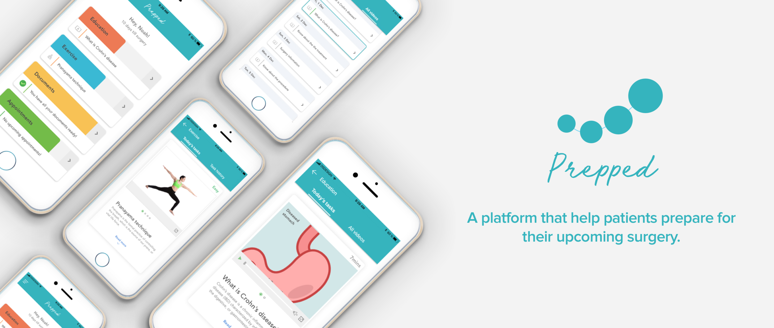 Prepped pre-surgery preparation app